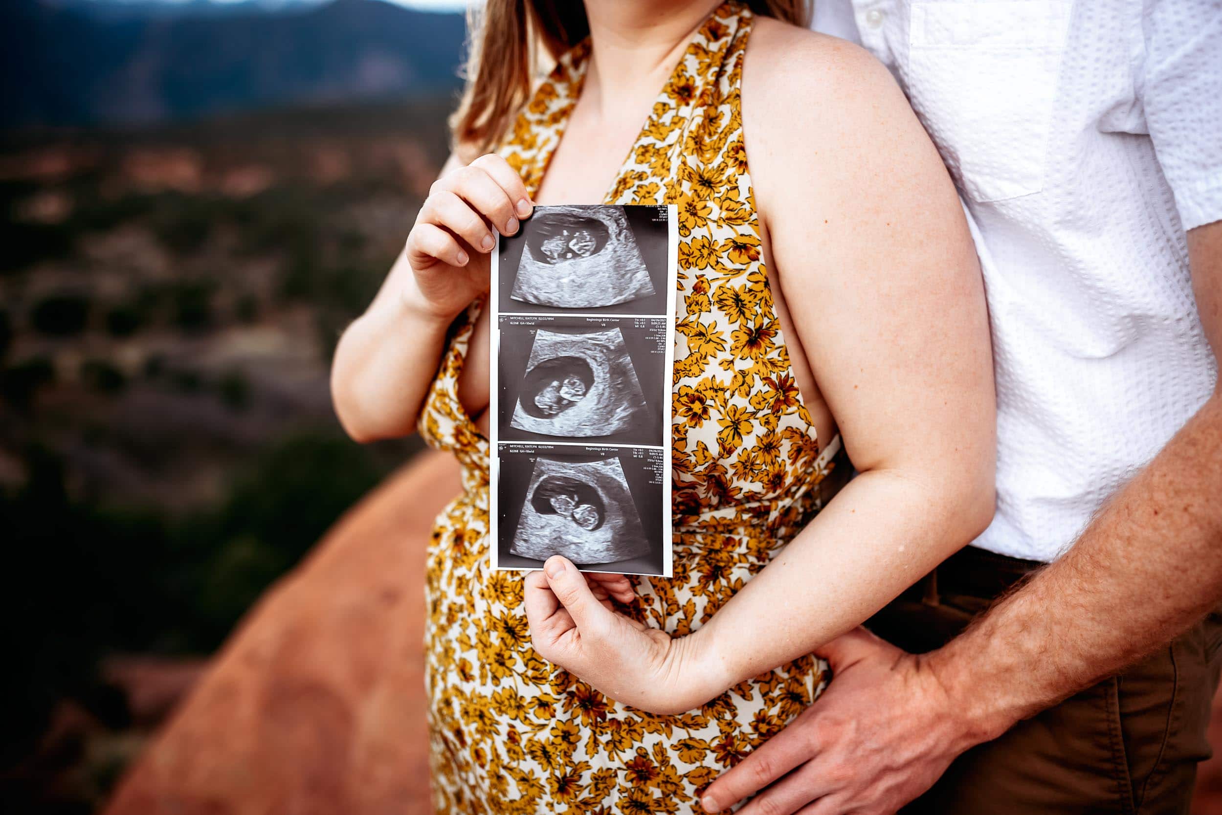 Ultrasound couples photo shoot